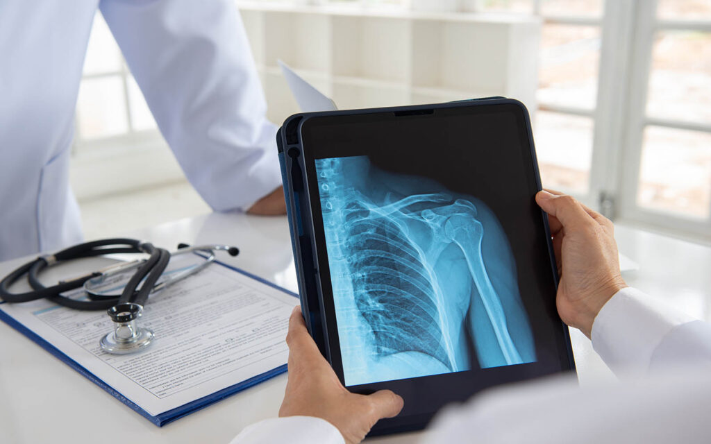 shoulder,joint,x ray,image,on,digital,tablet,with,doctor,team